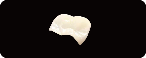 REECHMERRY Implant Superstructure Restoration — nano-zirconia dental restoration